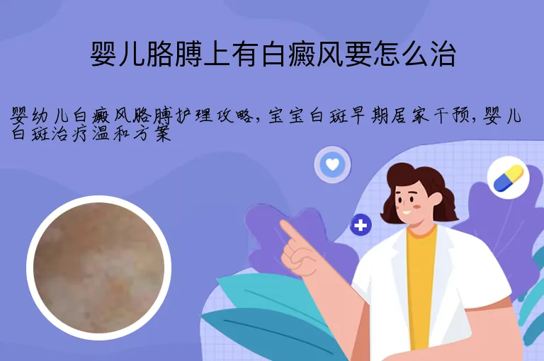 婴儿胳膊上有白癜风要怎么治