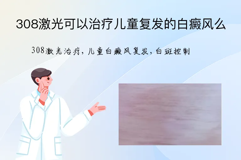 308激光可以治疗儿童复发的白癜风么