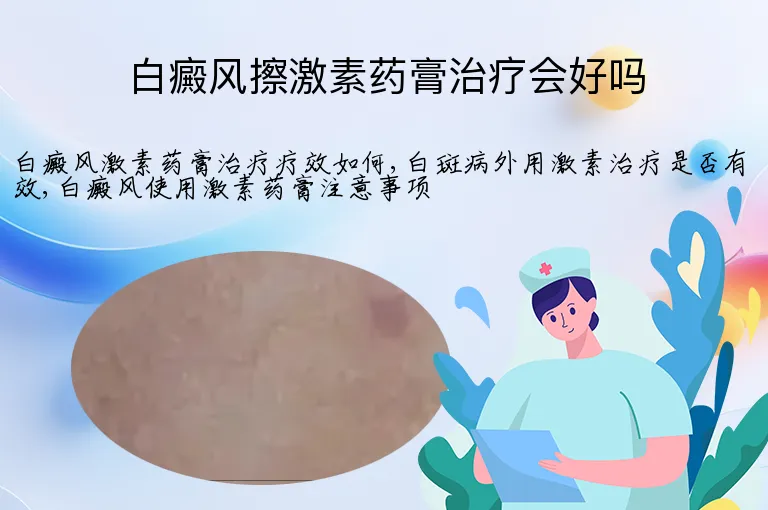 白癜风擦激素药膏治疗会好吗