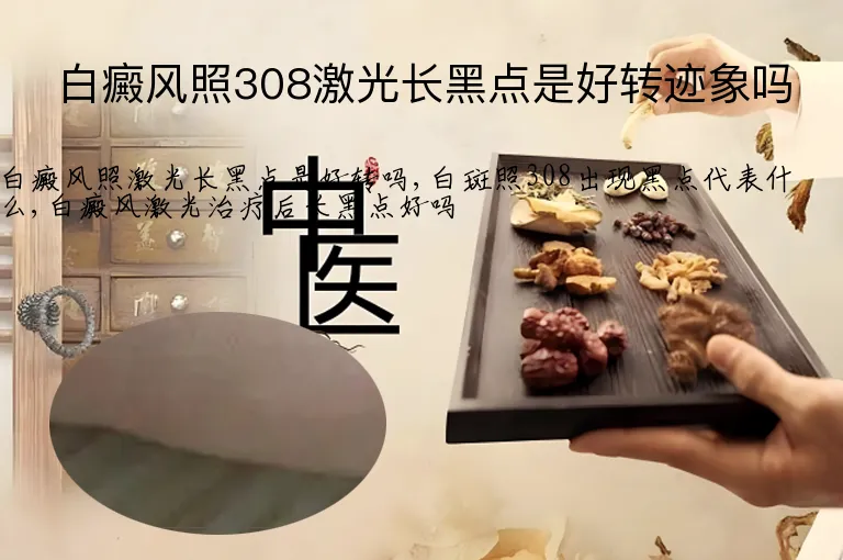 白癜风照308激光长黑点是好转迹象吗