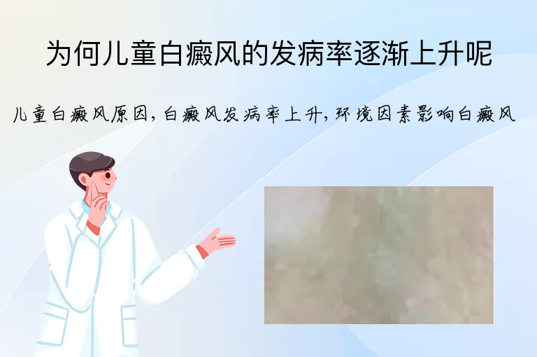 为何儿童白癜风的发病率逐渐上升呢