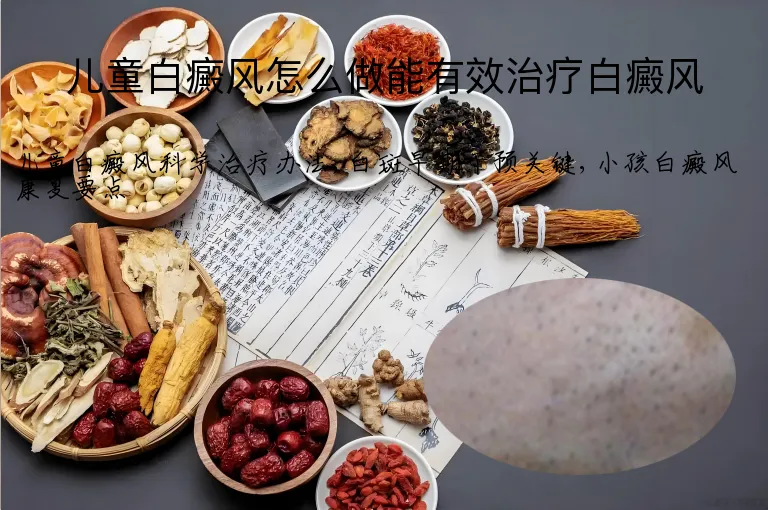 儿童白癜风怎么做能有效治疗白癜风