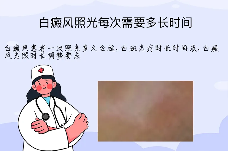 白癜风照光每次需要多长时间
