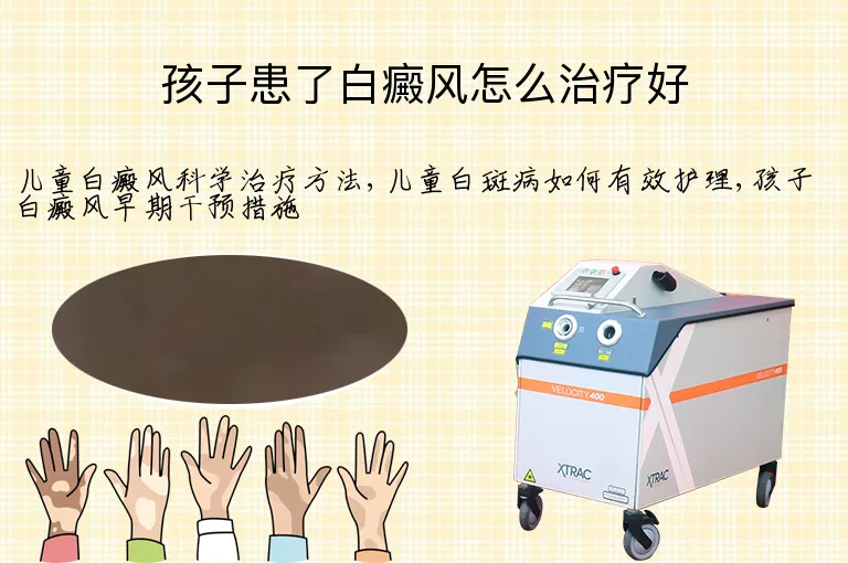孩子患了白癜风怎么治疗好