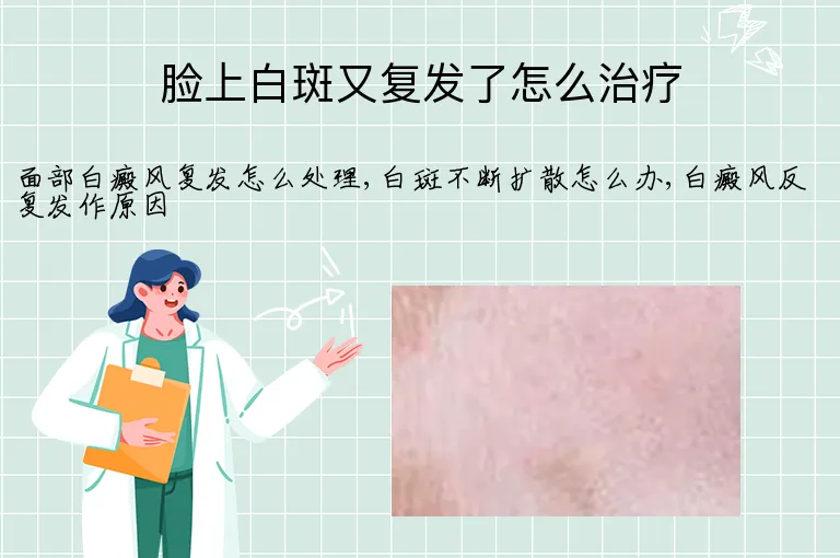 脸上白斑又复发了怎么治疗