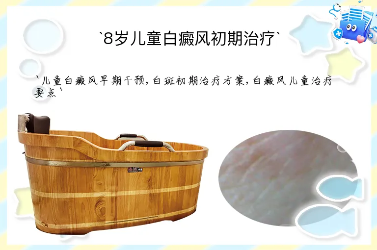 8岁儿童白癜风初期治疗