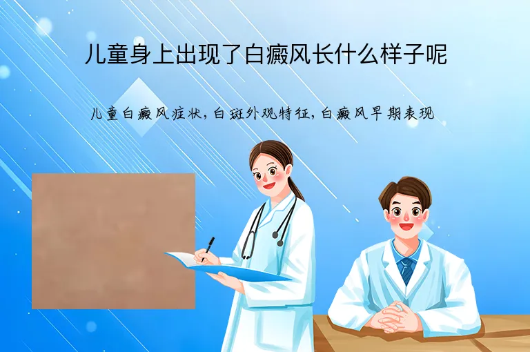儿童身上出现了白癜风长什么样子呢