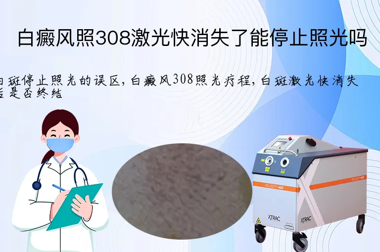 白癜风照308激光快消失了能停止照光吗