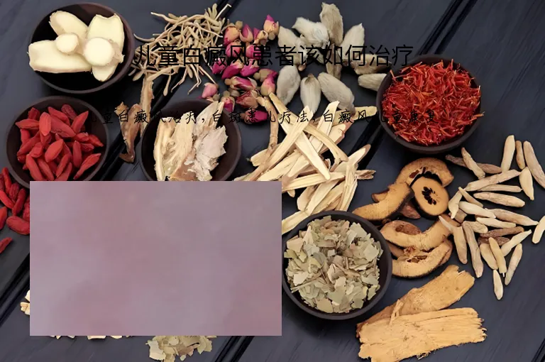 儿童白癜风患者该如何治疗