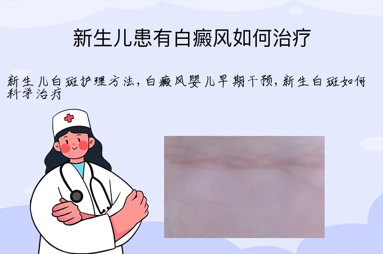 新生儿患有白癜风如何治疗