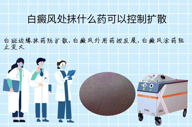白癜风处抹什么药可以控制扩散