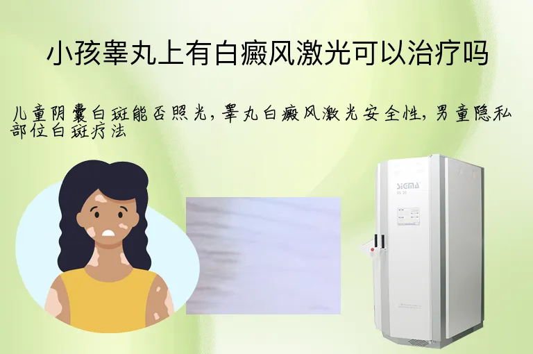 小孩睾丸上有白癜风激光可以治疗吗