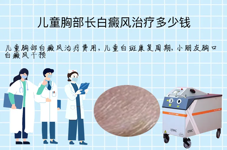 儿童胸部长白癜风治疗多少钱
