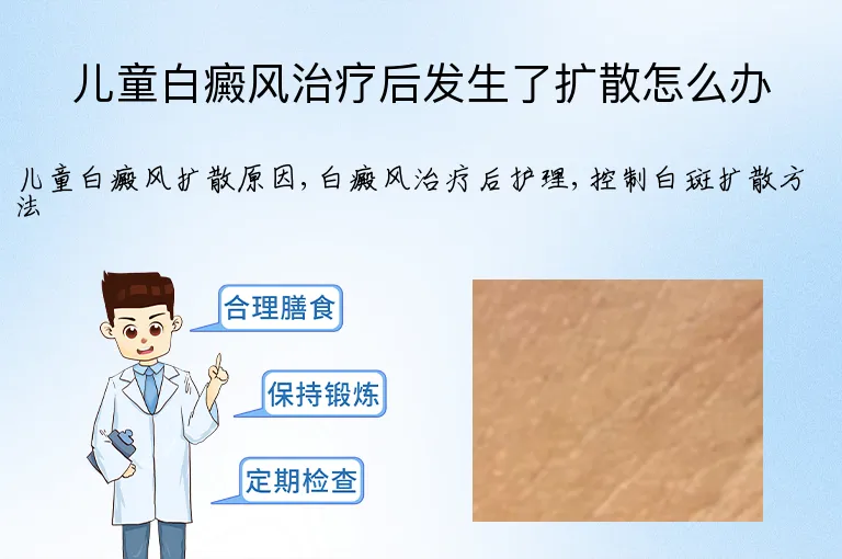儿童白癜风治疗后发生了扩散怎么办