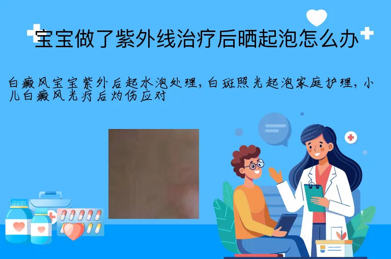 宝宝做了紫外线治疗后晒起泡怎么办