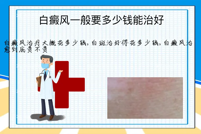 白癜风一般要多少钱能治好