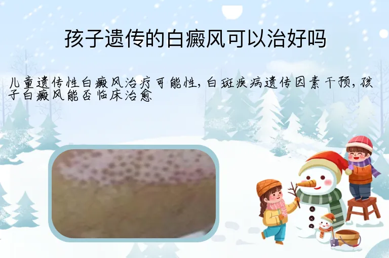 孩子遗传的白癜风可以治好吗