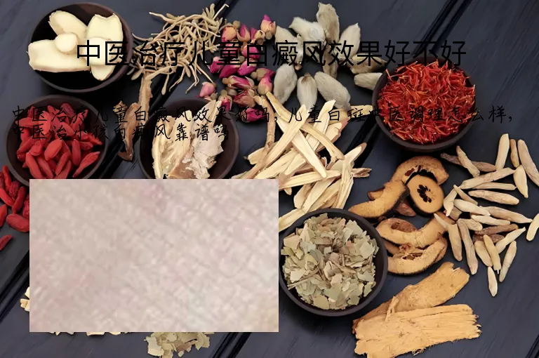 中医治疗儿童白癜风效果好不好