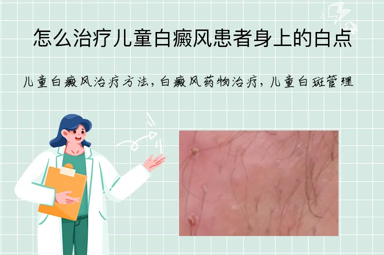怎么治疗儿童白癜风患者身上的白点