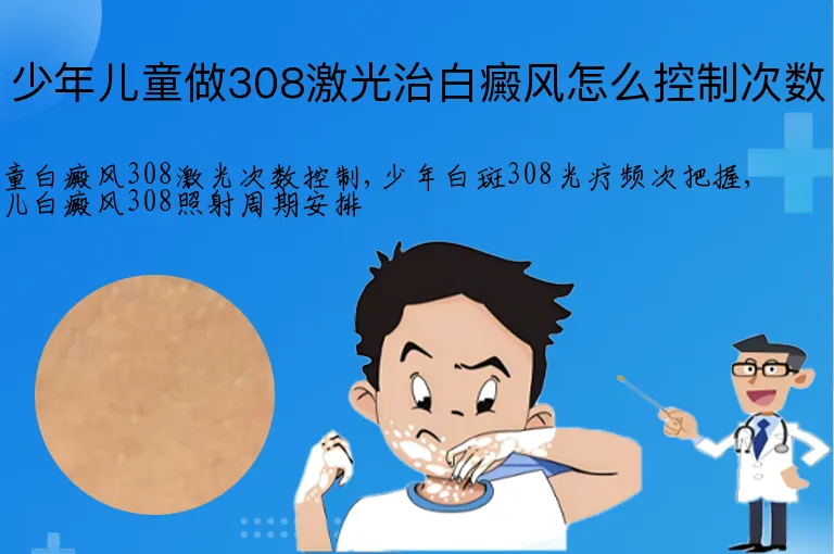 少年儿童做308激光治白癜风怎么控制次数