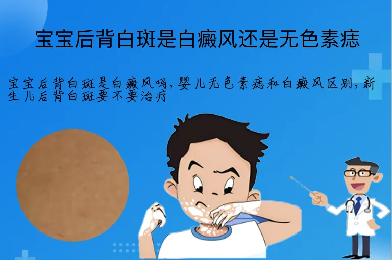宝宝后背白斑是白癜风还是无色素痣
