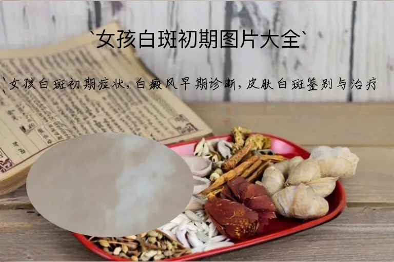女孩白斑初期图片大全