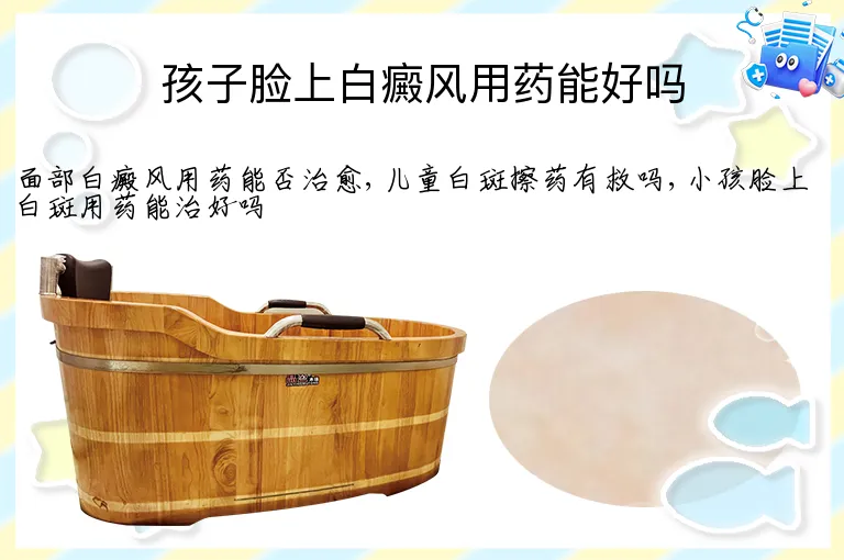 孩子脸上白癜风用药能好吗
