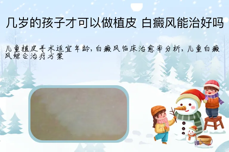 几岁的孩子才可以做植皮 白癜风能治好吗
