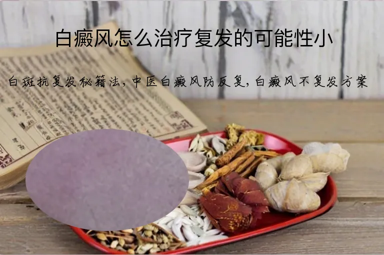 白癜风怎么治疗复发的可能性小