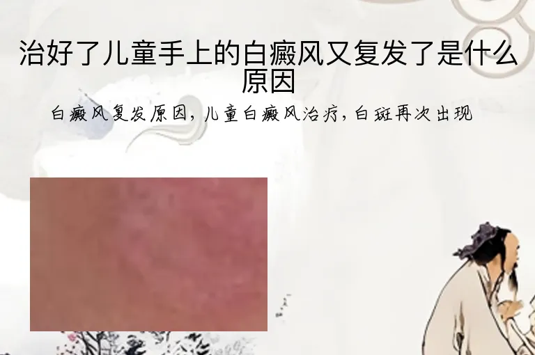治好了儿童手上的白癜风又复发了是什么原因