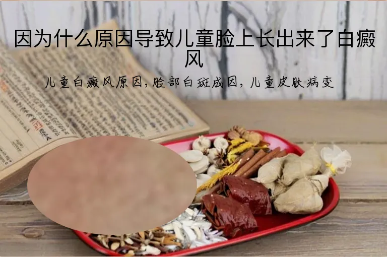 因为什么原因导致儿童脸上长出来了白癜风