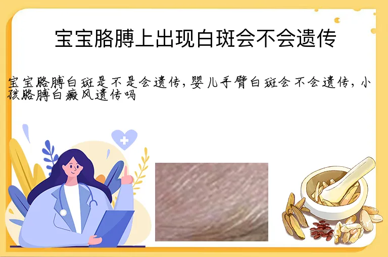 宝宝胳膊上出现白斑会不会遗传