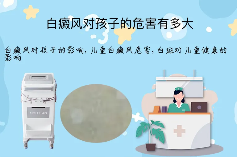 白癜风对孩子的危害有多大