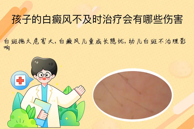 孩子的白癜风不及时治疗会有哪些伤害