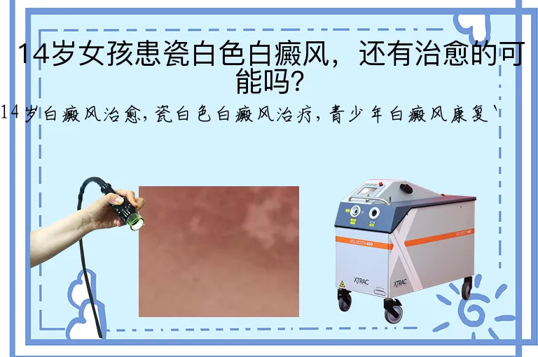 14岁女孩患瓷白色白癜风，还有治愈的可能吗？
