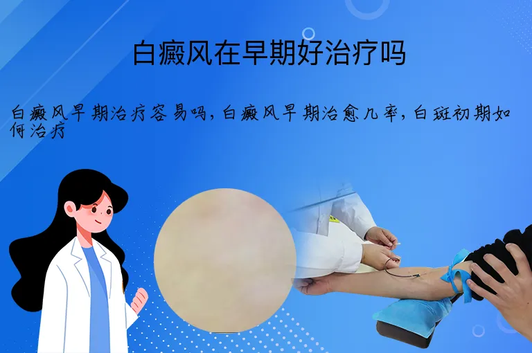 白癜风在早期好治疗吗