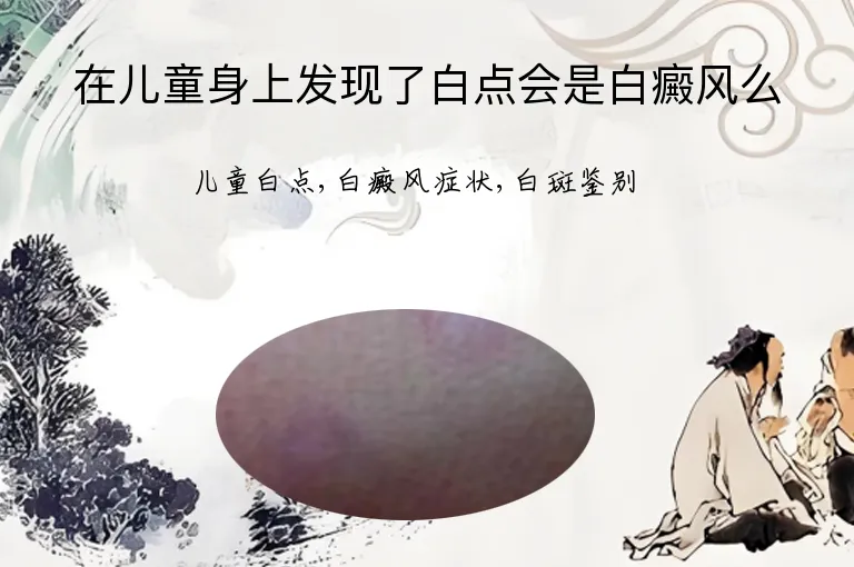 在儿童身上发现了白点会是白癜风么