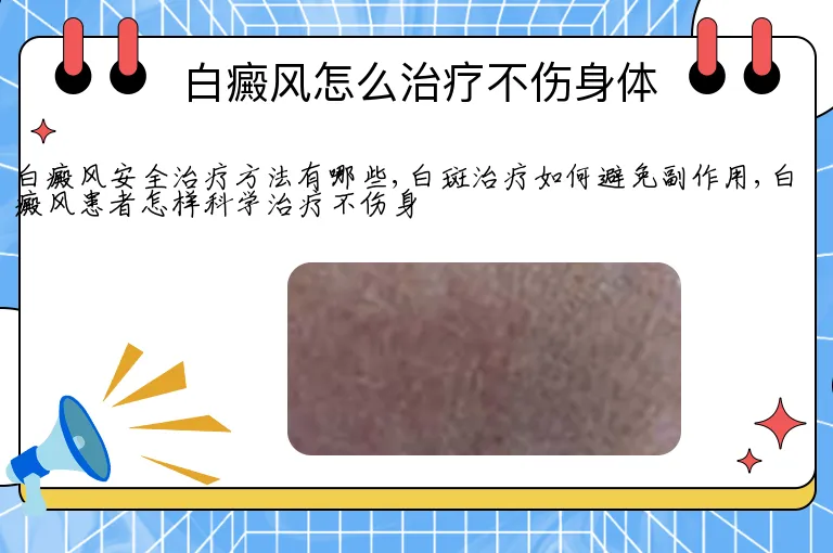 白癜风怎么治疗不伤身体