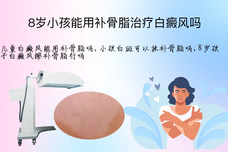 8岁小孩能用补骨脂治疗白癜风吗