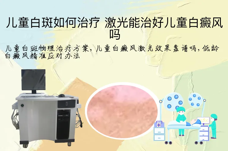 儿童白斑如何治疗 激光能治好儿童白癜风吗