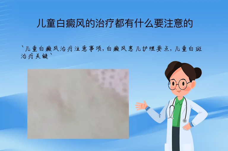 儿童白癜风的治疗都有什么要注意的