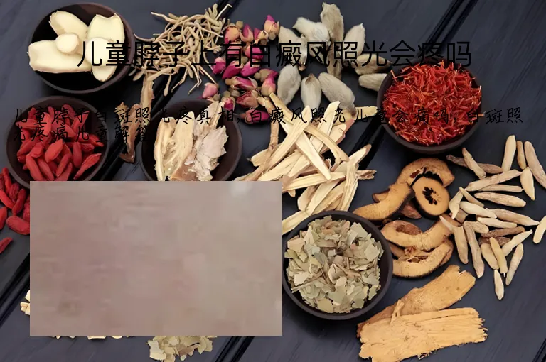 儿童脖子上有白癜风照光会疼吗