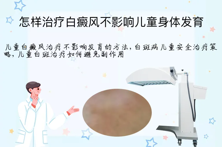 怎样治疗白癜风不影响儿童身体发育