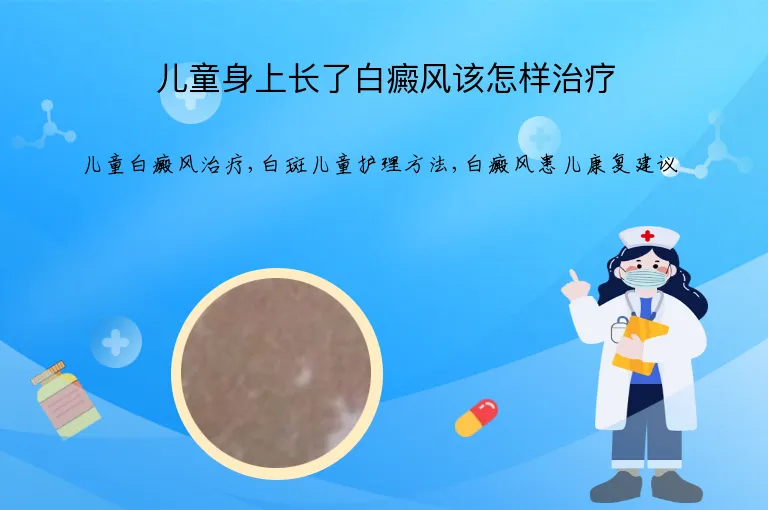 儿童身上长了白癜风该怎样治疗