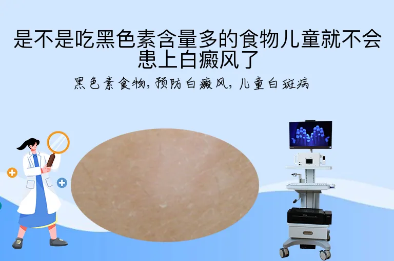 是不是吃黑色素含量多的食物儿童就不会患上白癜风了