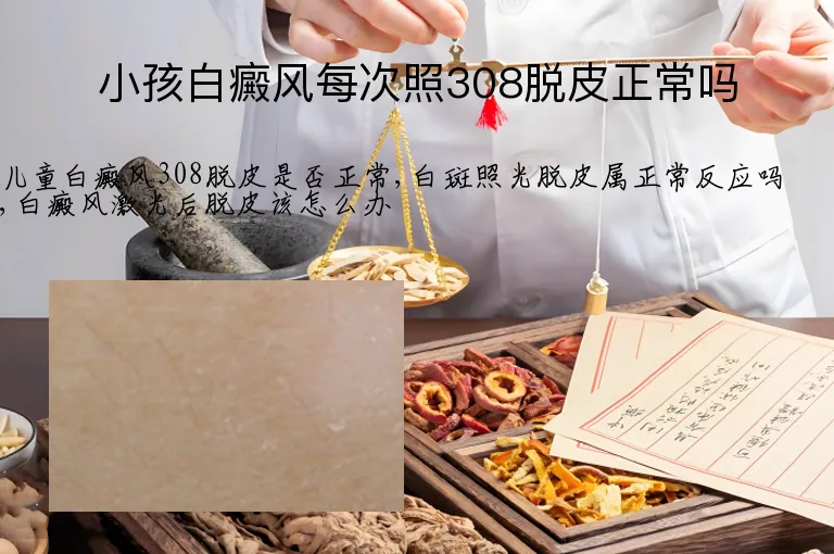 小孩白癜风每次照308脱皮正常吗