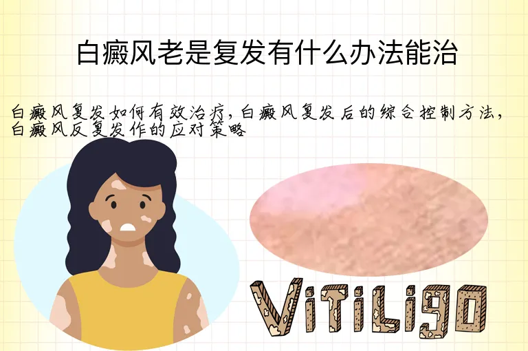 白癜风老是复发有什么办法能治