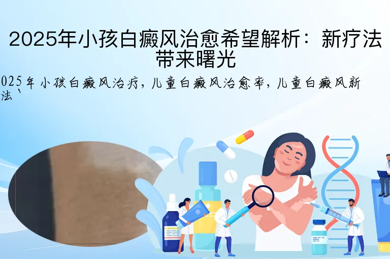 2025年小孩白癜风治愈希望解析：新疗法带来曙光