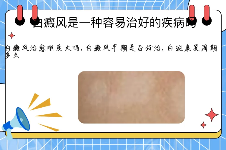 白癜风是一种容易治好的疾病吗
