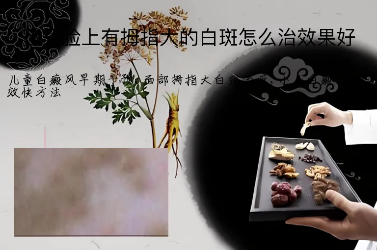 孩子脸上有拇指大的白斑怎么治效果好